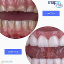 Carillas Dentales Snap on Smile ®