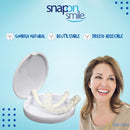 Carillas Dentales Snap on Smile ®