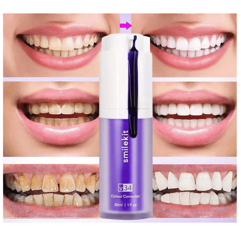 SmileKit - Blanqueador Dental - Sonrisa Radiante Sin Salir de Casa!