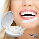 Carillas Dentales Snap on Smile ®