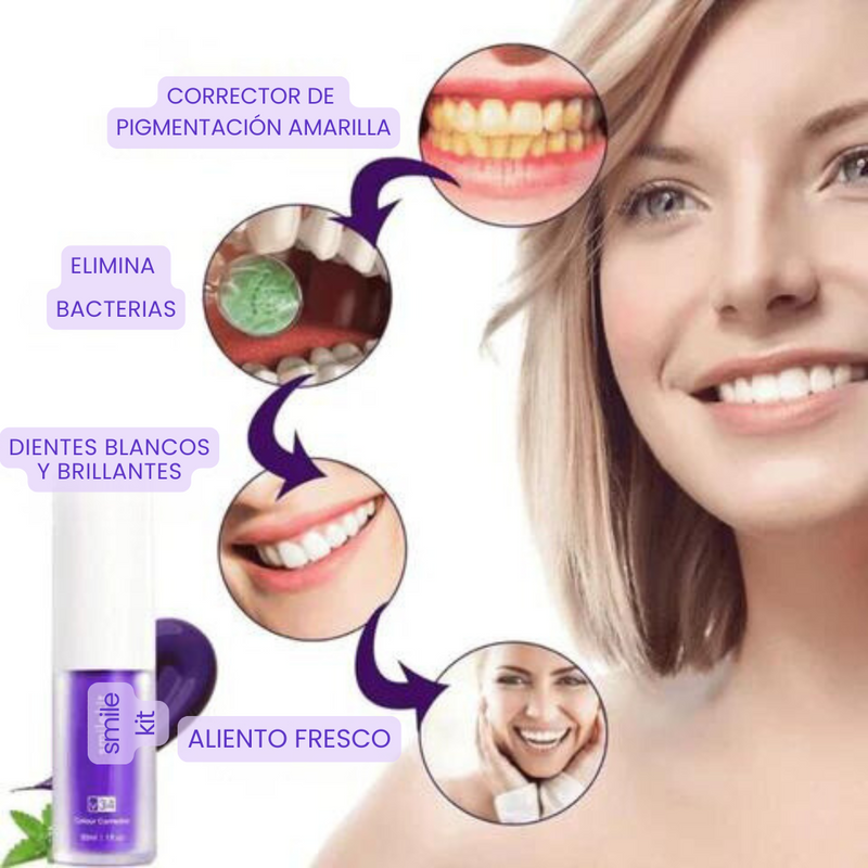 SmileKit - Blanqueador Dental - Sonrisa Radiante Sin Salir de Casa!