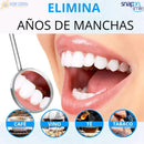 Carillas Dentales Snap on Smile ®