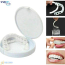 Carillas Dentales Snap on Smile ®